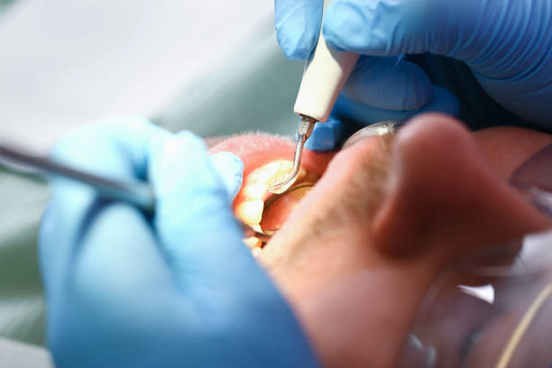 Best Emergency Dental Care for Abscessed Tooth in Roseto, PA