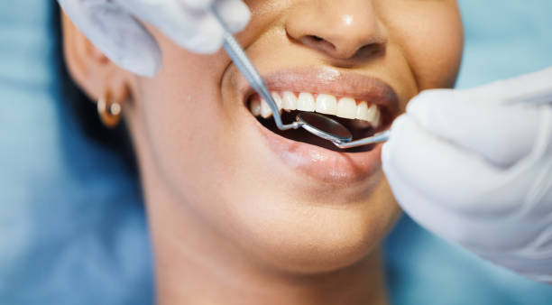 Best Emergency Dental Extractions in Roseto, PA